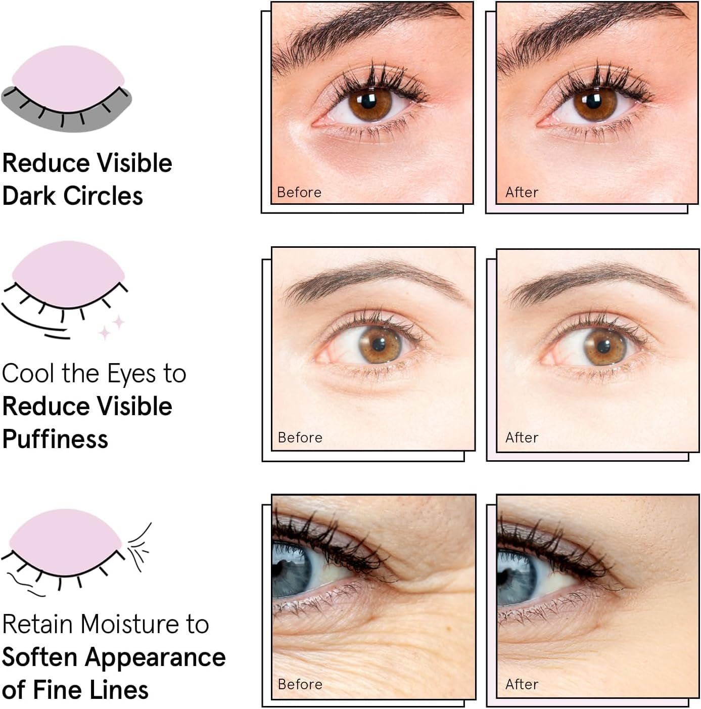 under Eye Patches (12 Pairs) Eye Masks for Puffy Eyes and Dark Circles - Stocking Stuffers, Christmas Gifts for Women - Gifts for Birthdays, Bachelorette Party, Bridesmaids, Self Care