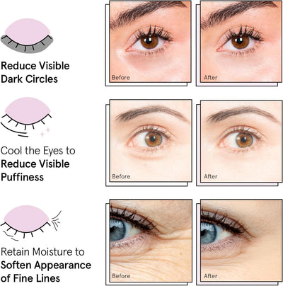 under Eye Patches (12 Pairs) Eye Masks for Puffy Eyes and Dark Circles - Stocking Stuffers, Christmas Gifts for Women - Gifts for Birthdays, Bachelorette Party, Bridesmaids, Self Care